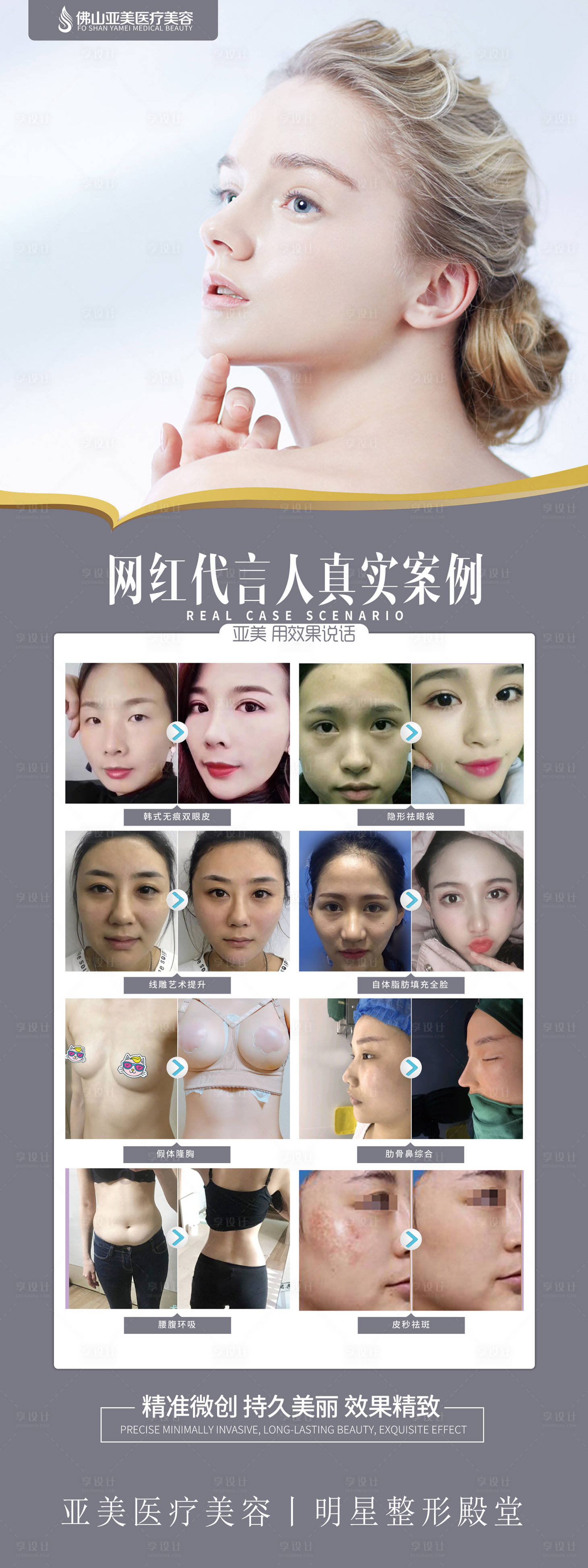 源文件下載【醫美案例展架】編號：61760000333496916