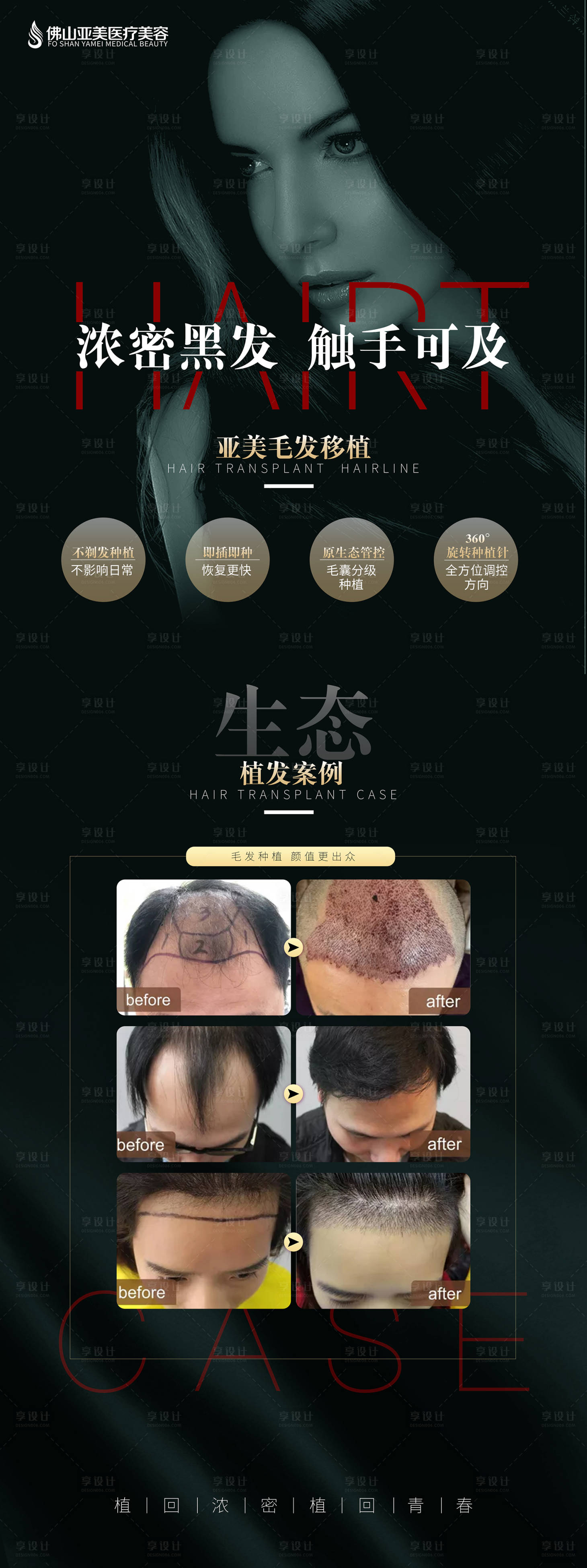 源文件下載【享設計】搜索編號：10190000333517263【毛發種植X展架】