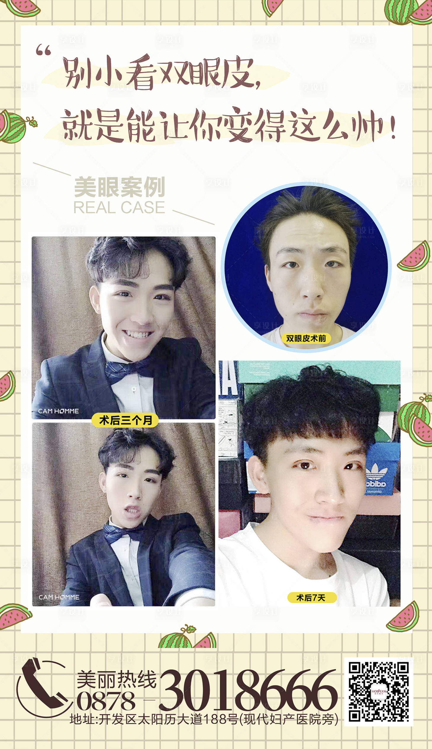 源文件下載【享設計】搜索編號：82380000466576937【雙眼皮對比圖醫美海報】
