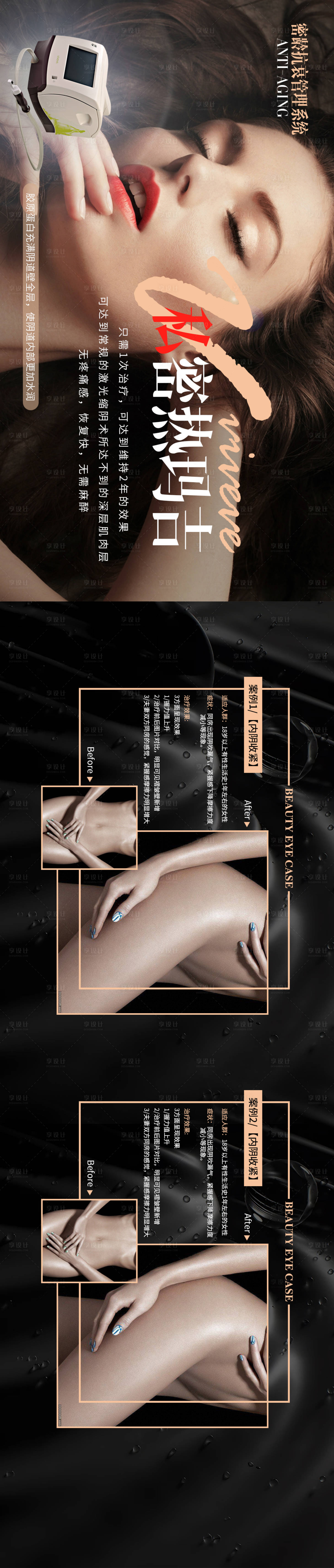 源文件下载【私密热玛吉美容仪器宣传海报】编号：29840001054884361