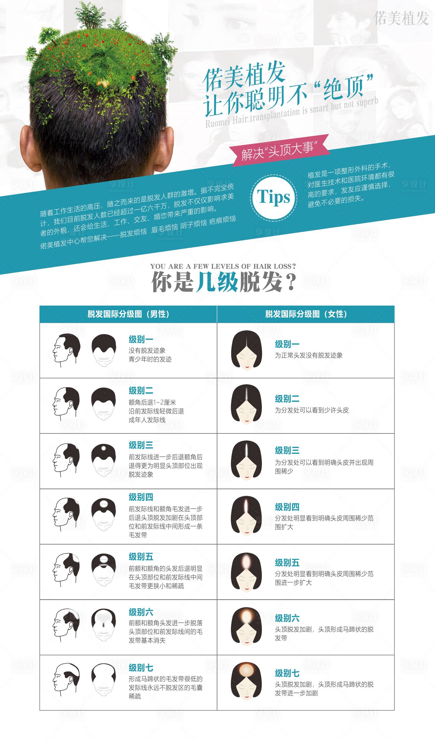 源文件下载【医美植发脱发等级海报】编号：77090001067743119