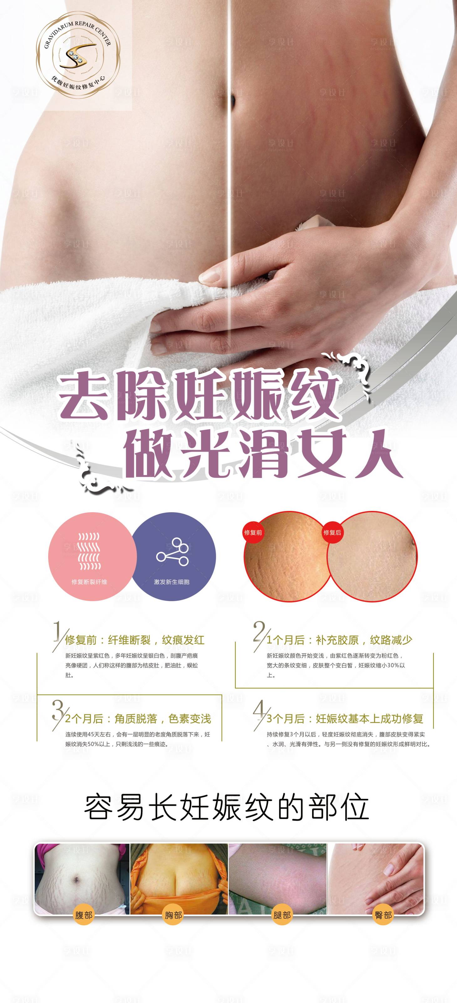 源文件下載【享設計】搜索編號：88490001705925469【妊娠紋展架】