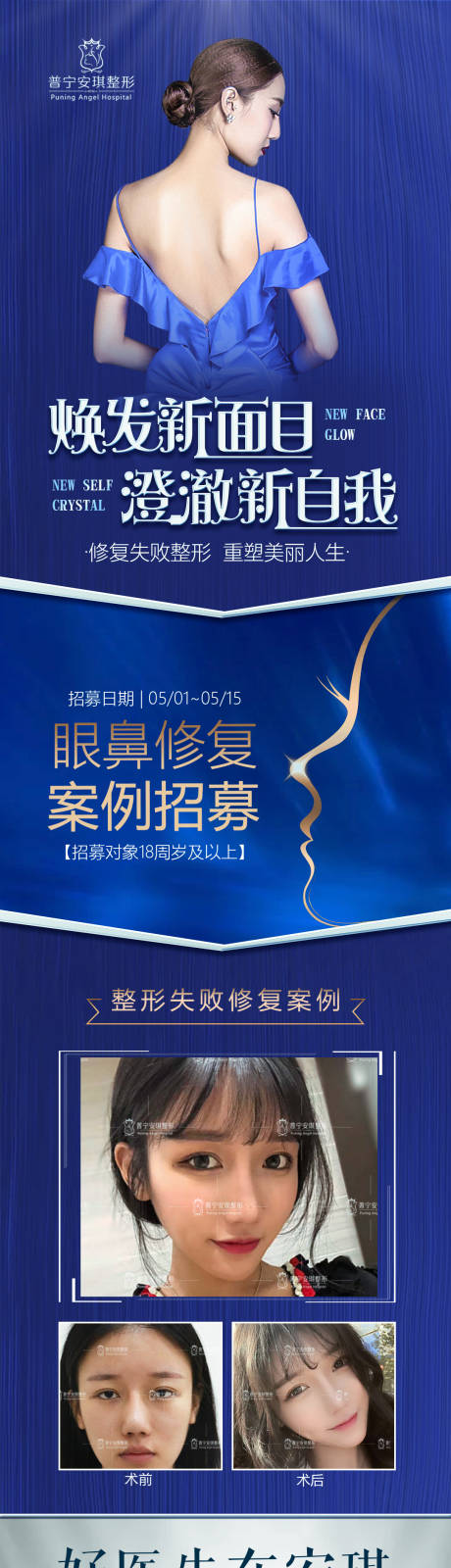 源文件下载【医美整形宣传活动长图海报】编号：54680001953504717