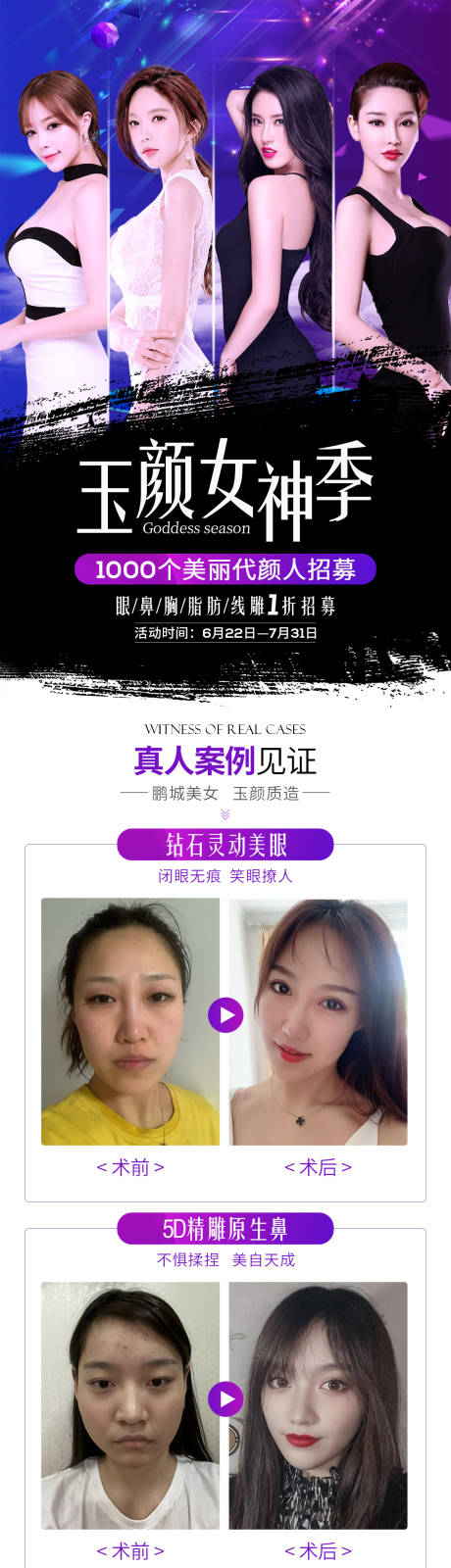 源文件下载【美容整形模特招募长图海报】编号：97380002129096038
