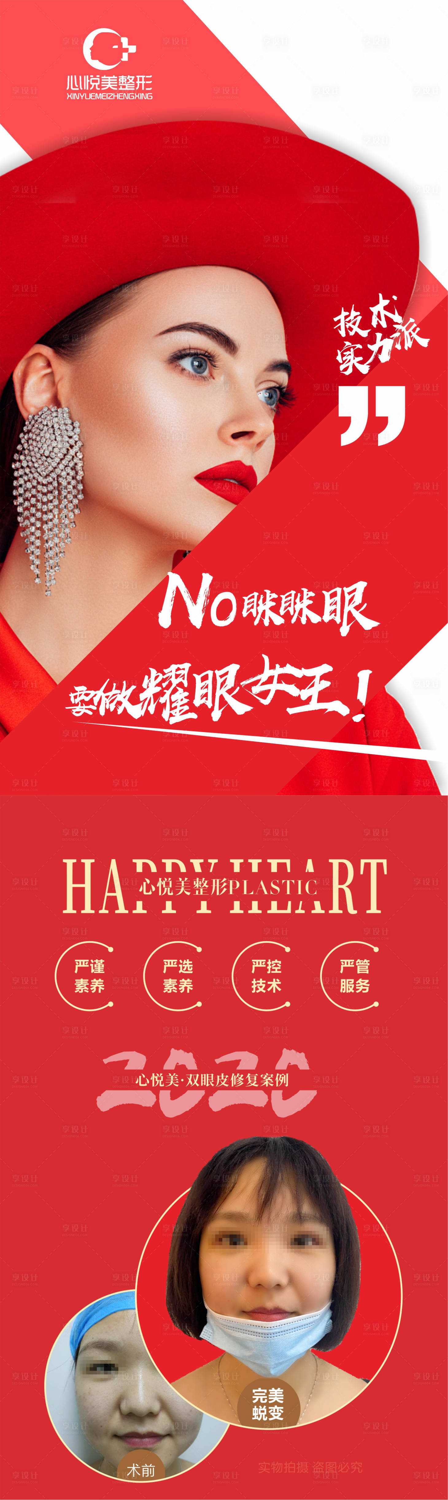 源文件下载【享设计】搜索编号：43360002089301059【双眼皮案例长图】