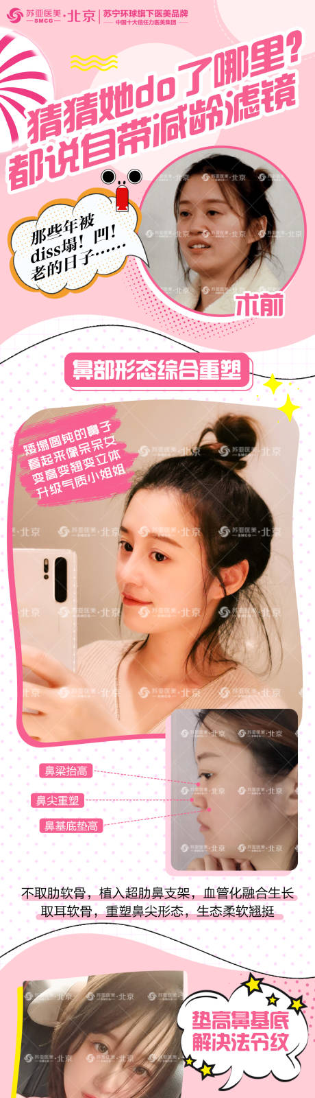 源文件下载【整形美容鼻整形招募长图创意海报】编号：53500001948751004
