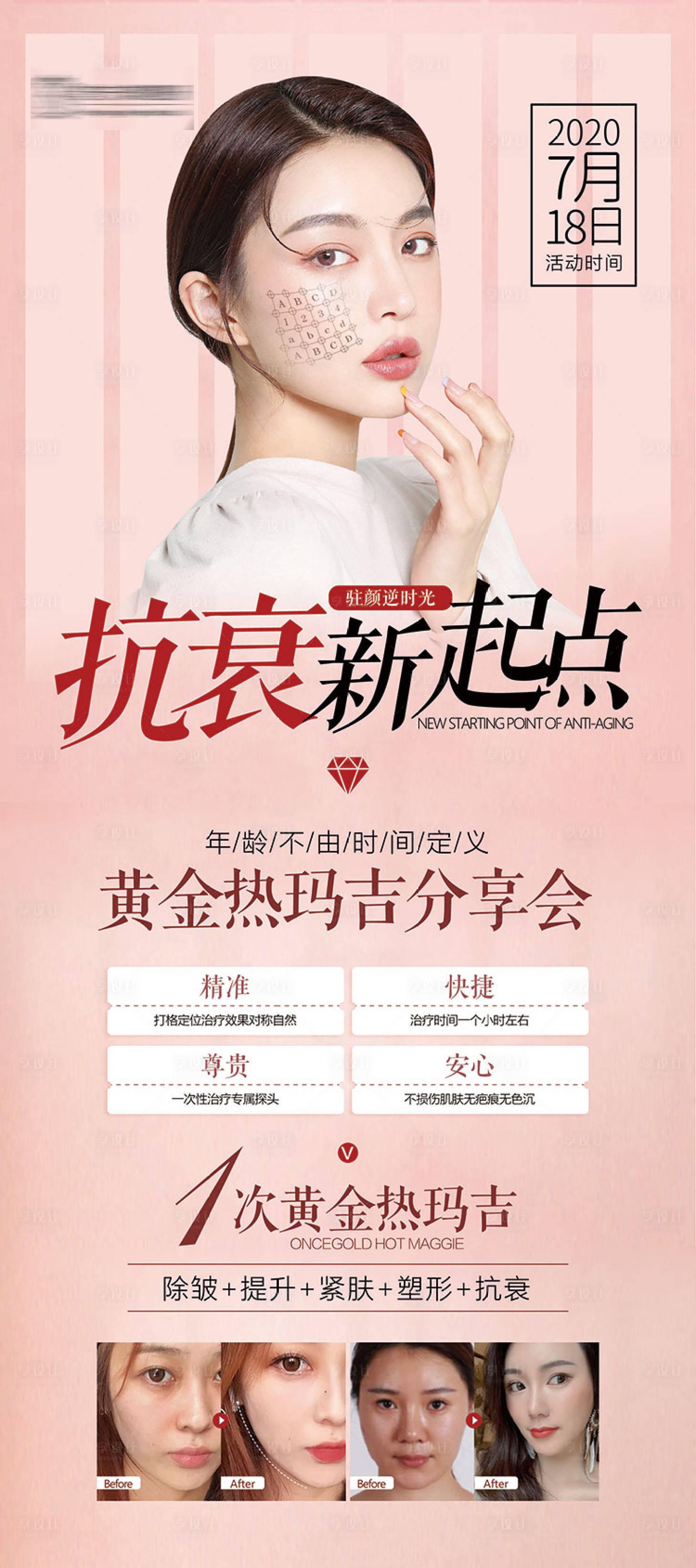 源文件下载【享设计】搜索编号：47660001673018449【医美整形热玛吉展架】