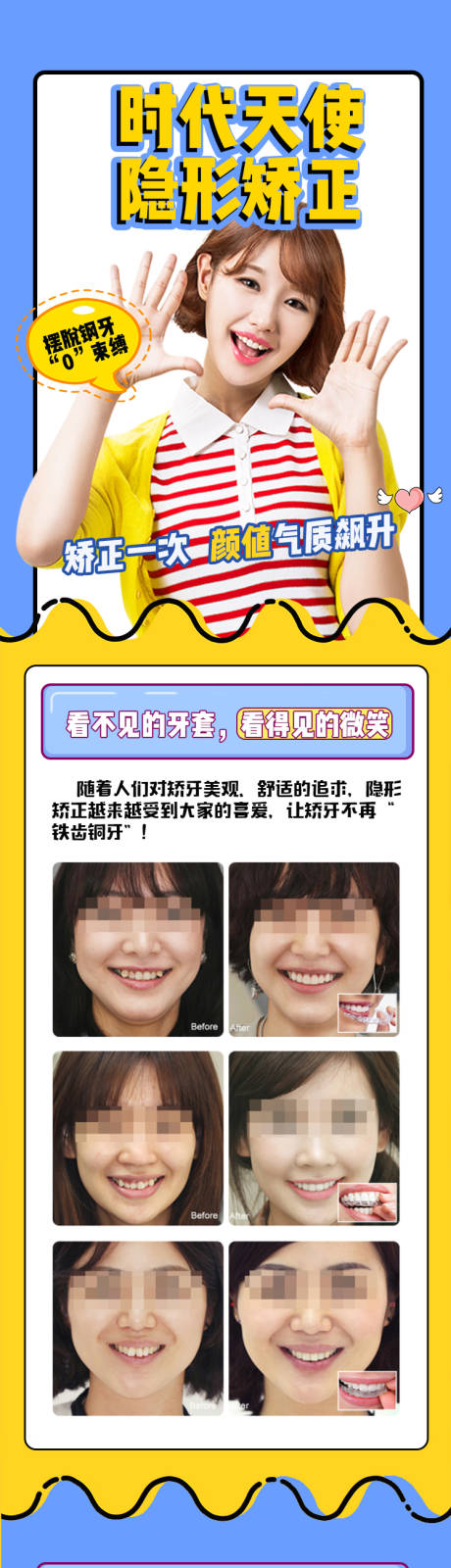 源文件下载【新氧时代天使隐形矫正详情页】编号：95390002125506804