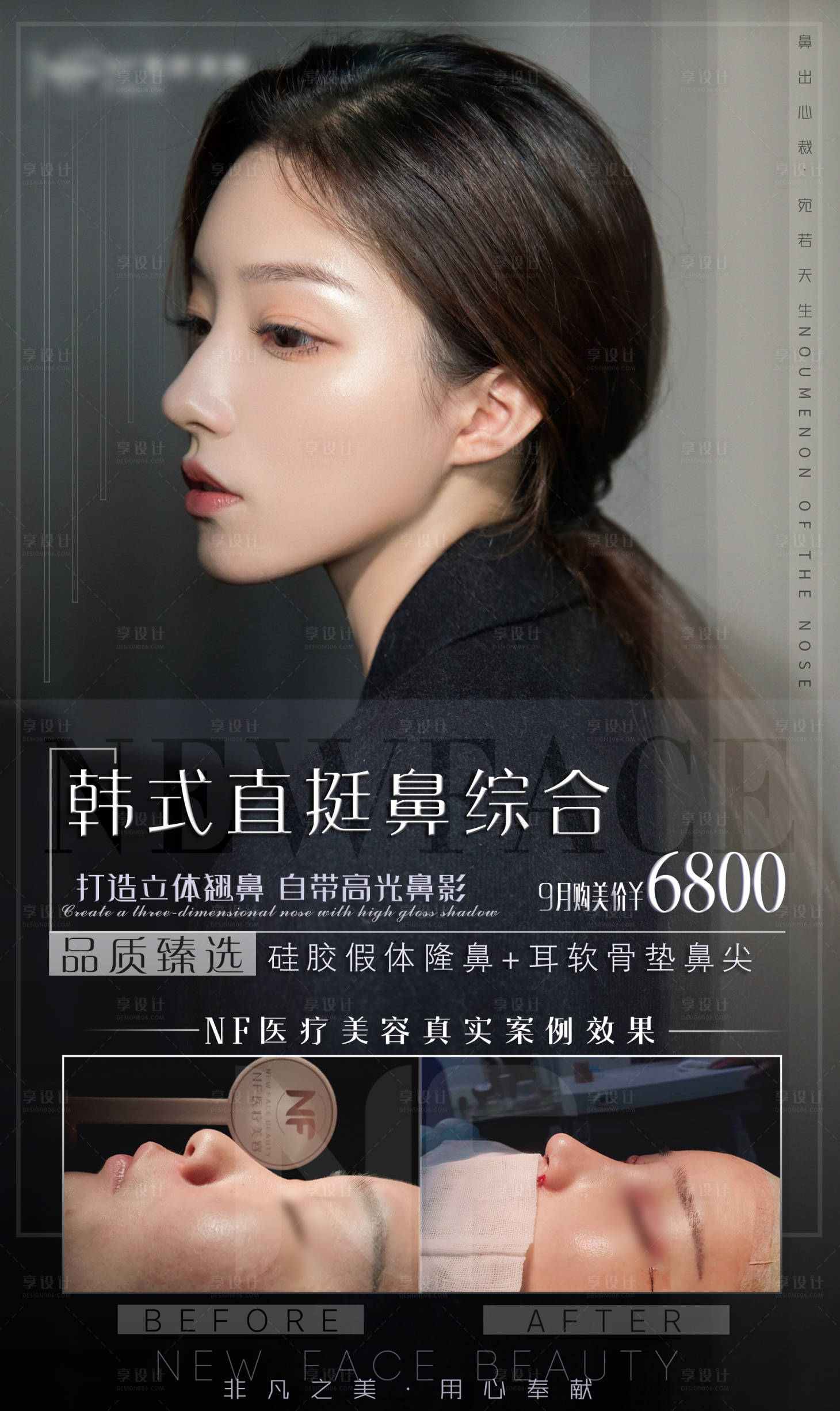 源文件下载【医美整形鼻综合隆鼻优惠活动】编号：64940002281706017