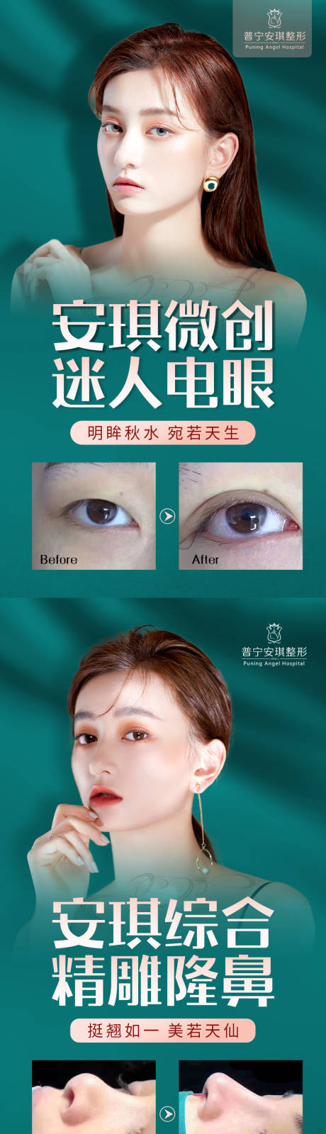 源文件下載【醫(yī)美雙眼皮隆鼻海報(bào)】編號(hào)：49320002425014914