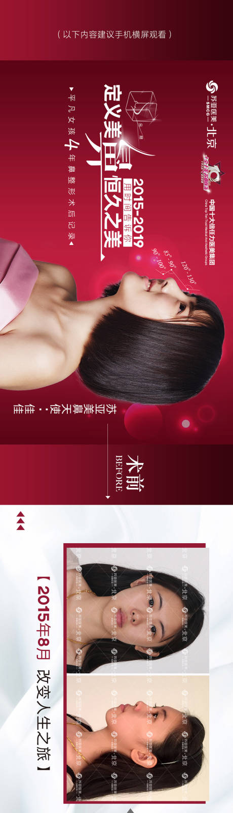 源文件下载【医美案例长图】编号：82490002152863385
