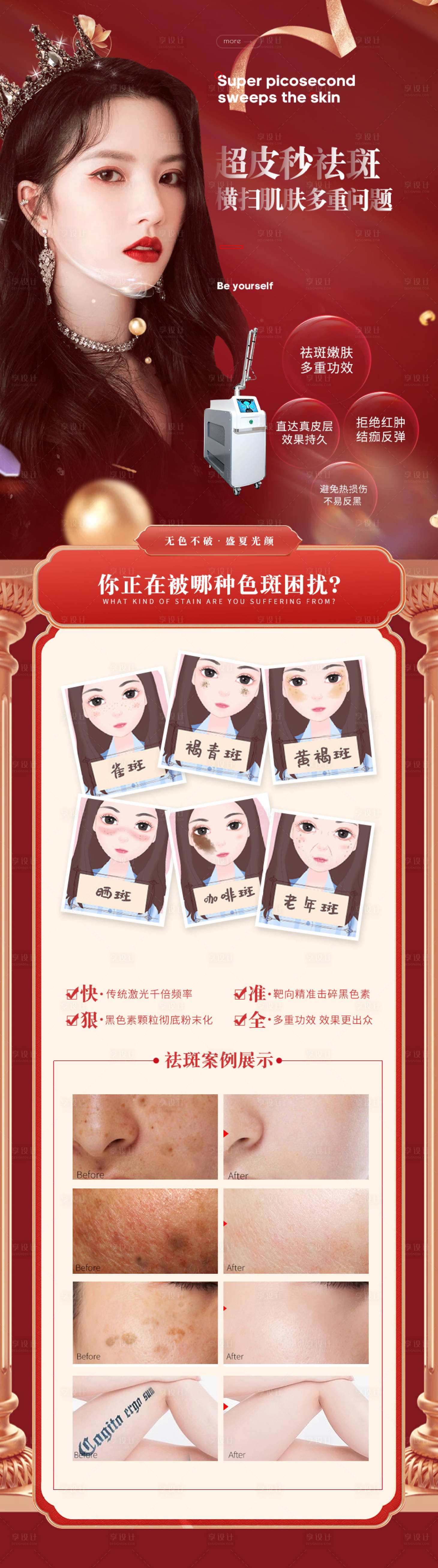 源文件下載【超皮秒祛斑案例海報(bào)】編號：58020002428713316