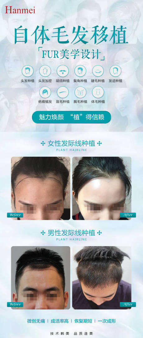 源文件下载【医美植发海报】编号：14460002693357393