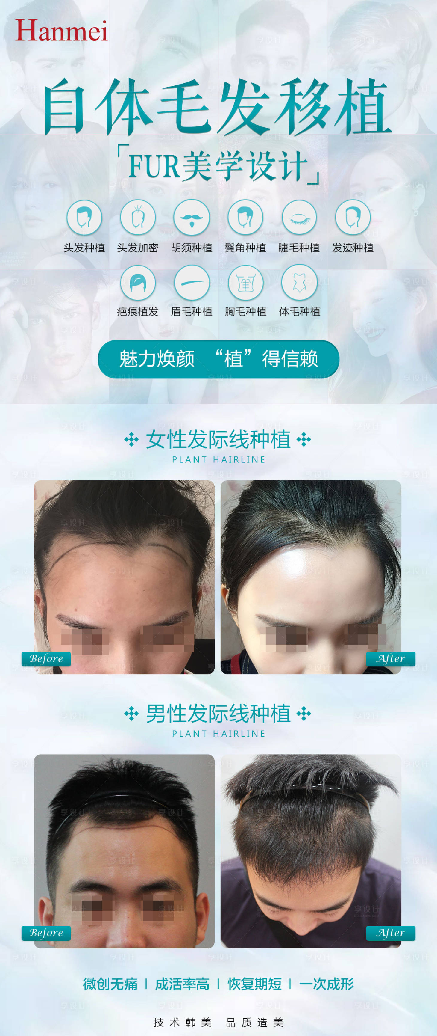 源文件下载【享设计】搜索编号：14460002693357393【医美植发海报】