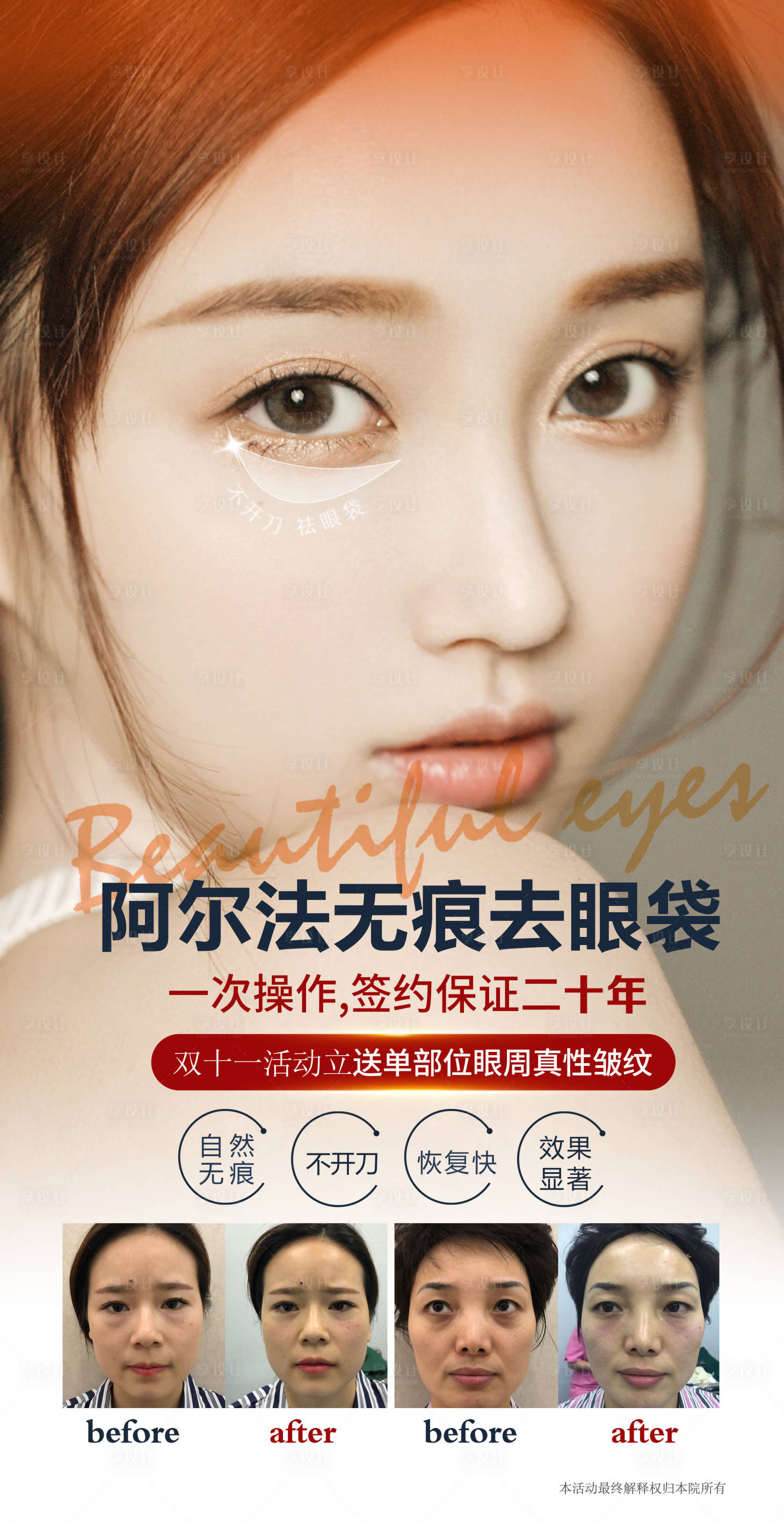 源文件下载【享设计】搜索编号：22110002473586114【医美去眼袋海报】