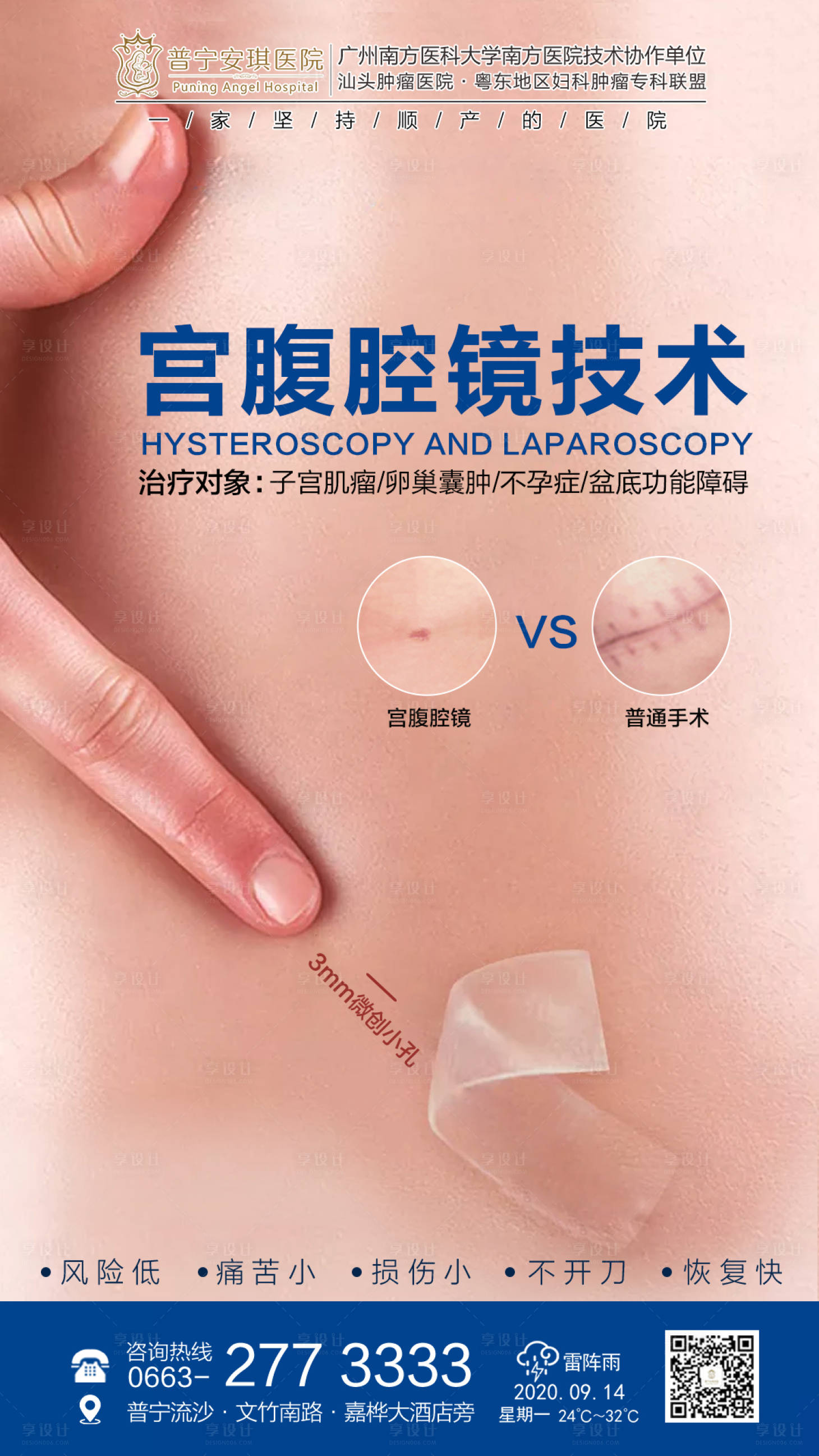 源文件下载【享设计】搜索编号：22240002525914988【宫腹腔镜医疗海报】