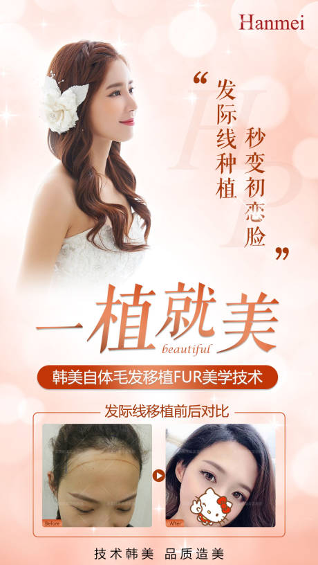 源文件下载【医美植发海报】编号：71750002658674872