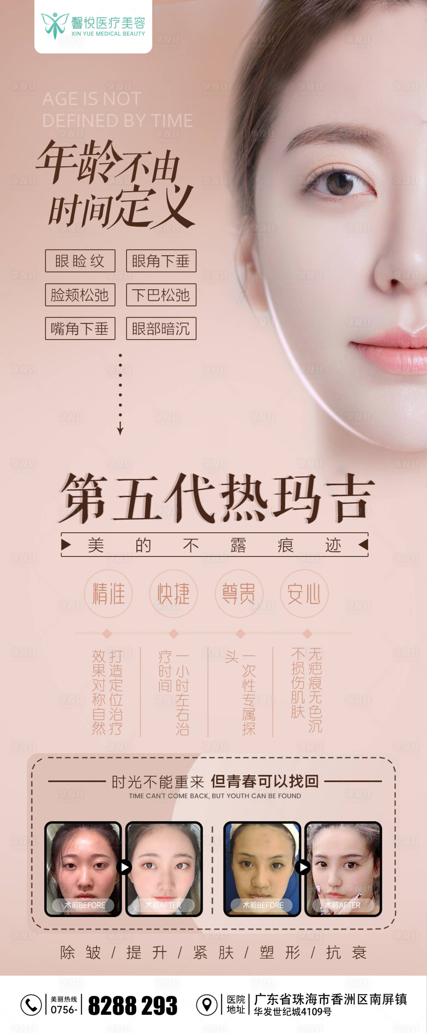 源文件下载【第五代热玛吉宣传海报】编号：17340002996481187
