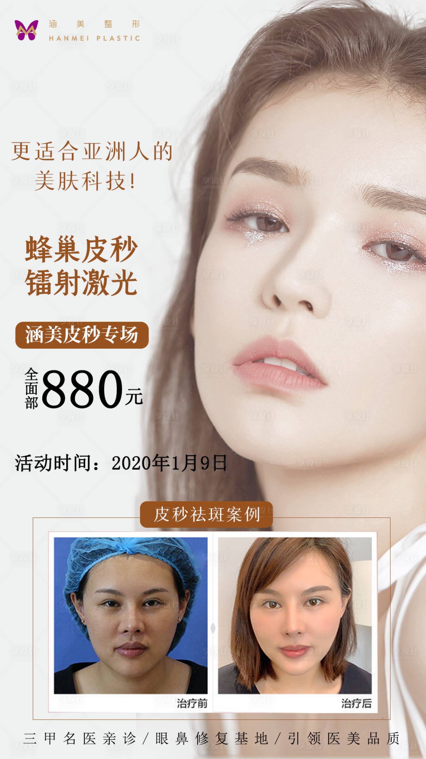 源文件下载【享设计】搜索编号：43420003055881653【医美皮秒】