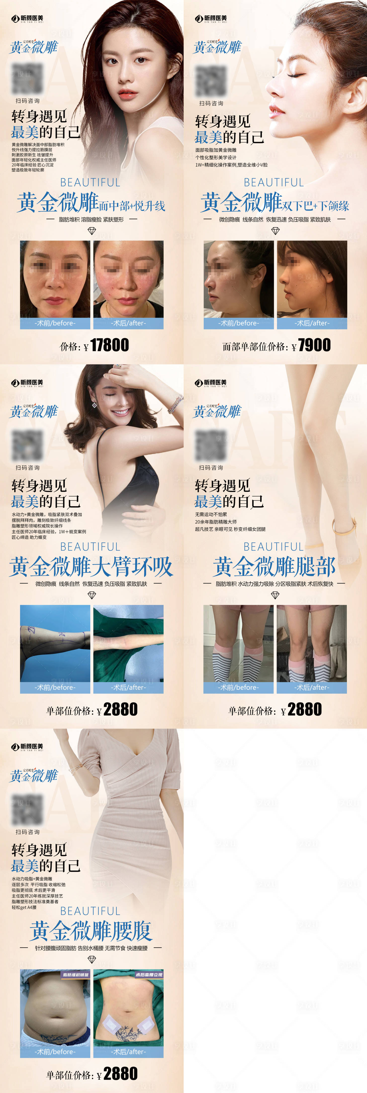 源文件下載【享設(shè)計(jì)】搜索編號(hào)：33420002826114849【醫(yī)美整形黃金微雕案例對(duì)比宣傳海報(bào)】