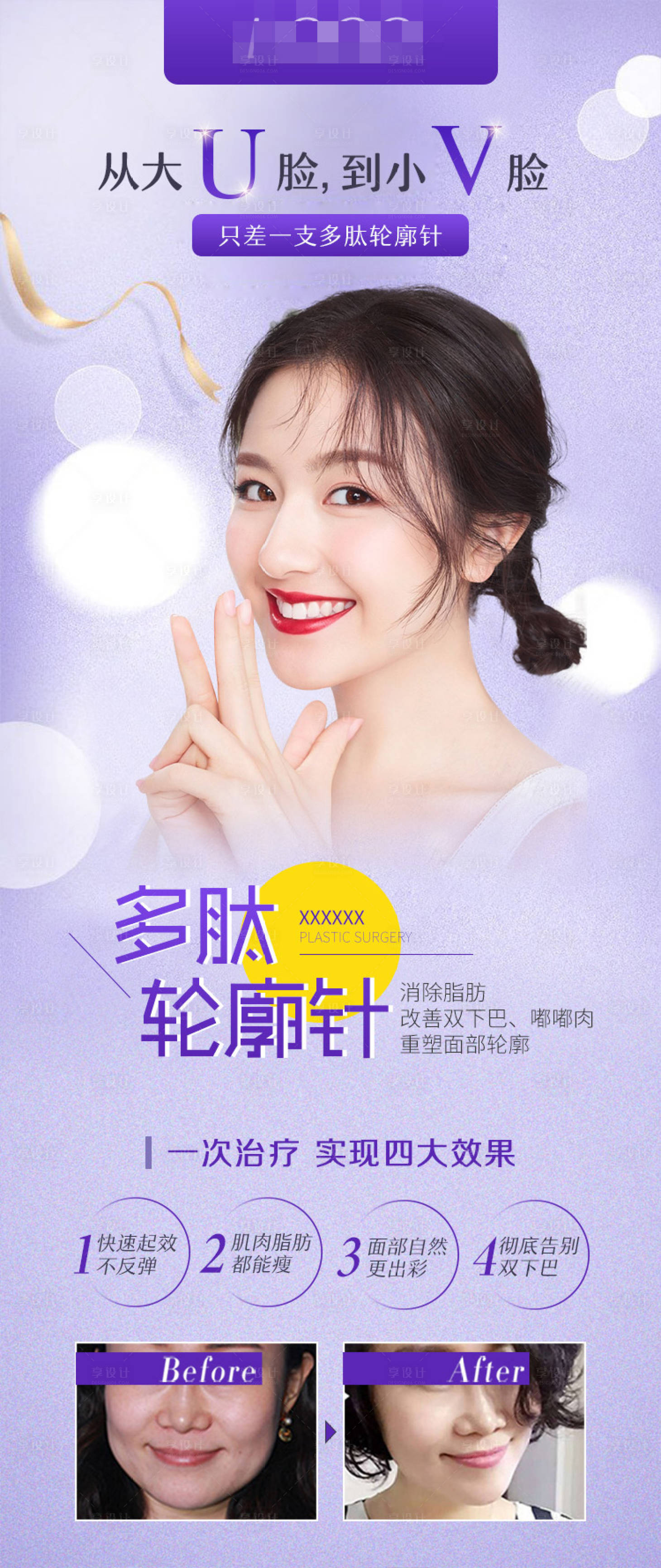 源文件下载【医美整形瘦脸轮廓针海报】编号：49200003280591465