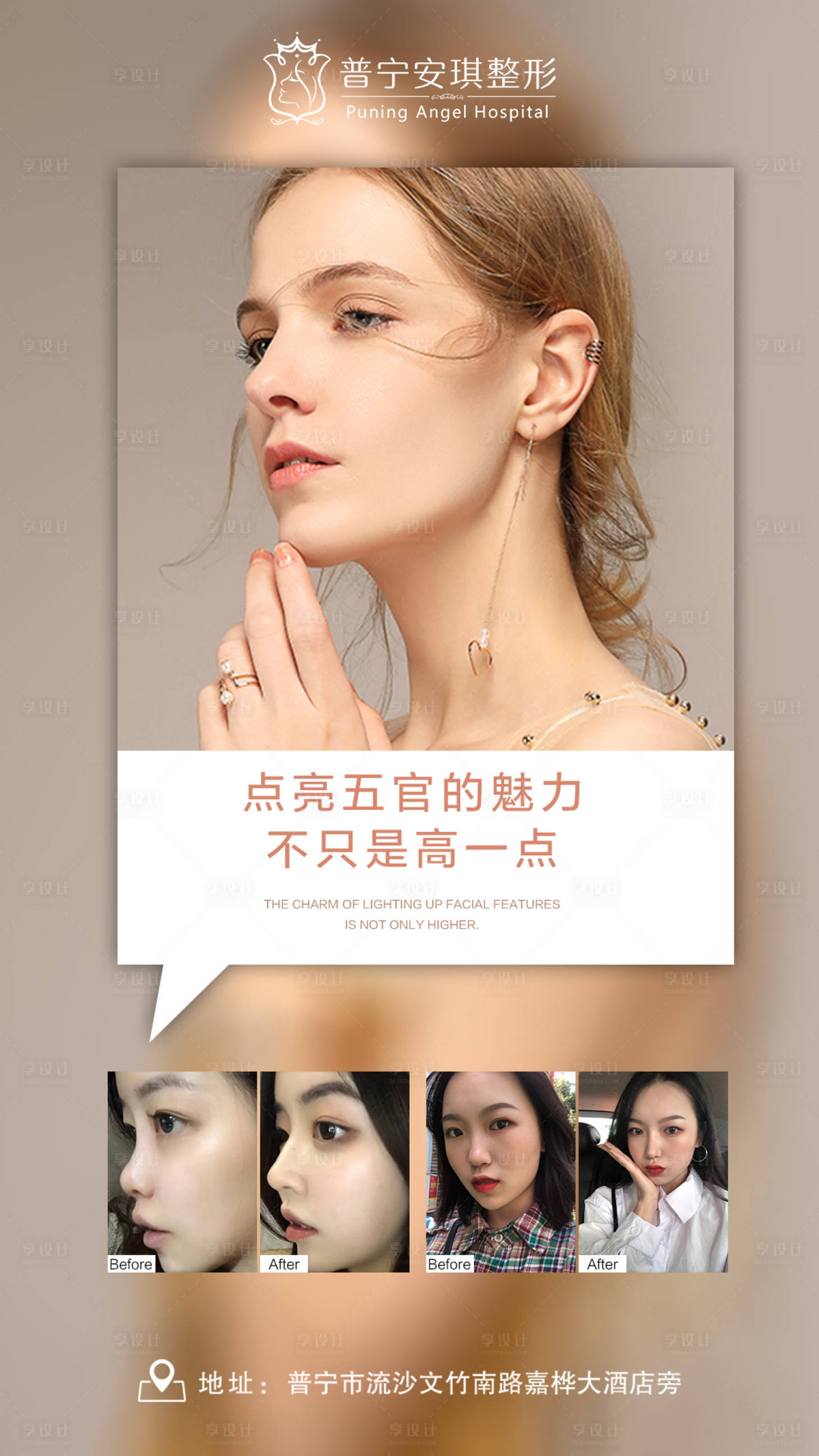 源文件下载【享设计】搜索编号：49530003192605165【医美隆鼻整形对比海报】