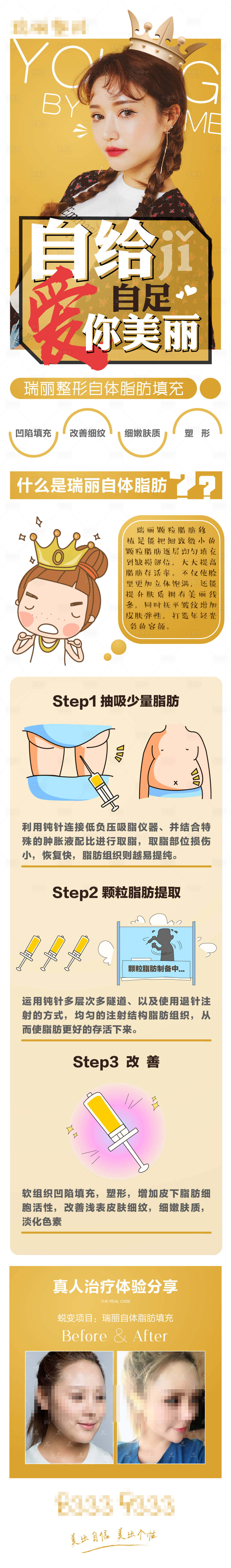 源文件下載【享設(shè)計(jì)】搜索編號(hào)：96790003260026609【醫(yī)美自體脂肪填充新氧長(zhǎng)圖】
