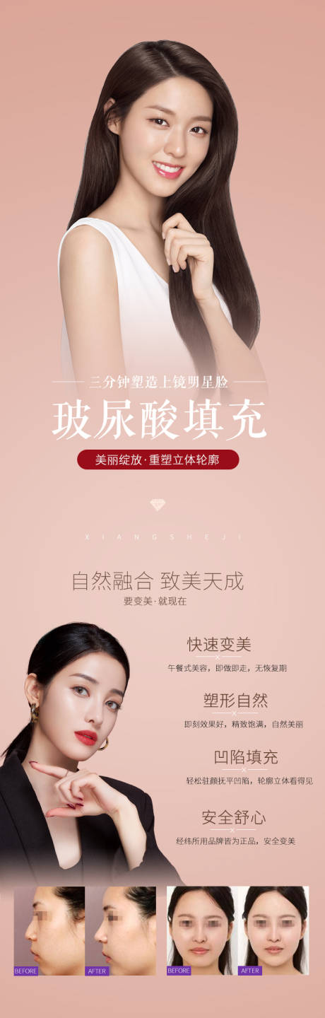 源文件下载【医美整形美容玻尿酸填充长图】编号：77530003292273960