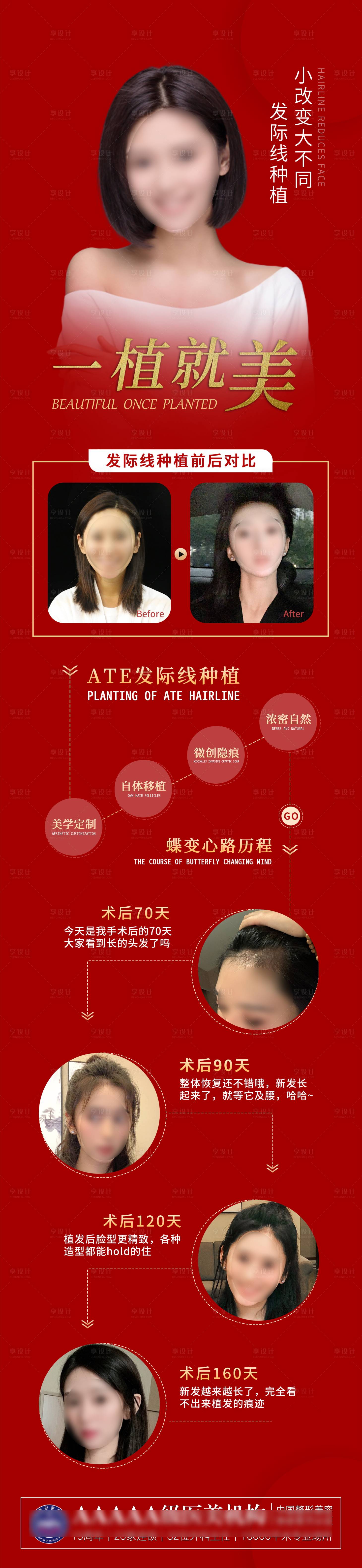 源文件下載【享設計】搜索編號：53640003212708188【醫美宣傳長圖  】
