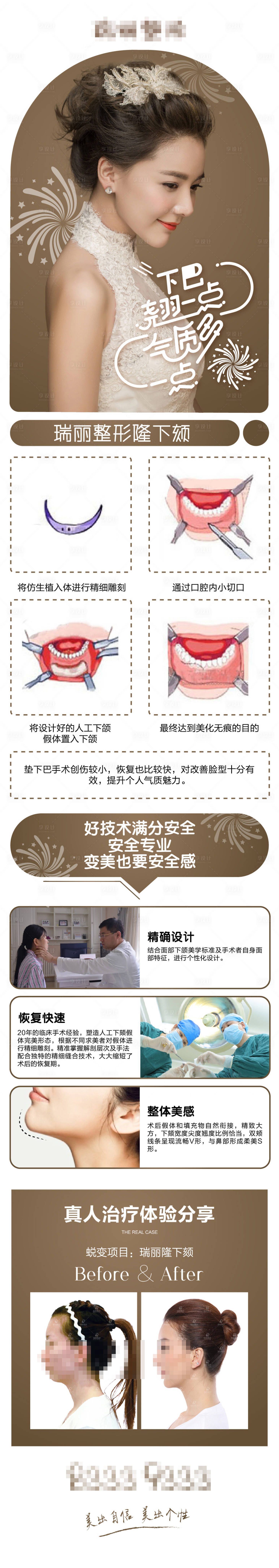 源文件下载【享设计】搜索编号：97940003222769799【医疗美容隆下巴新氧详情页】