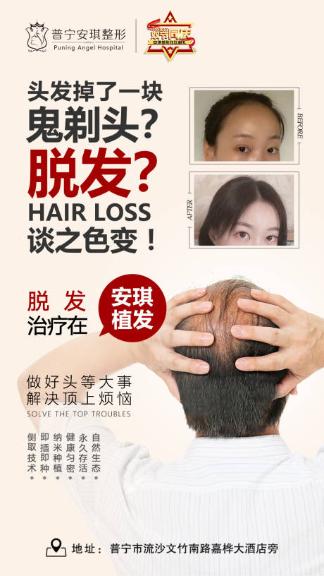 源文件下载【植发】编号：91210003087892702