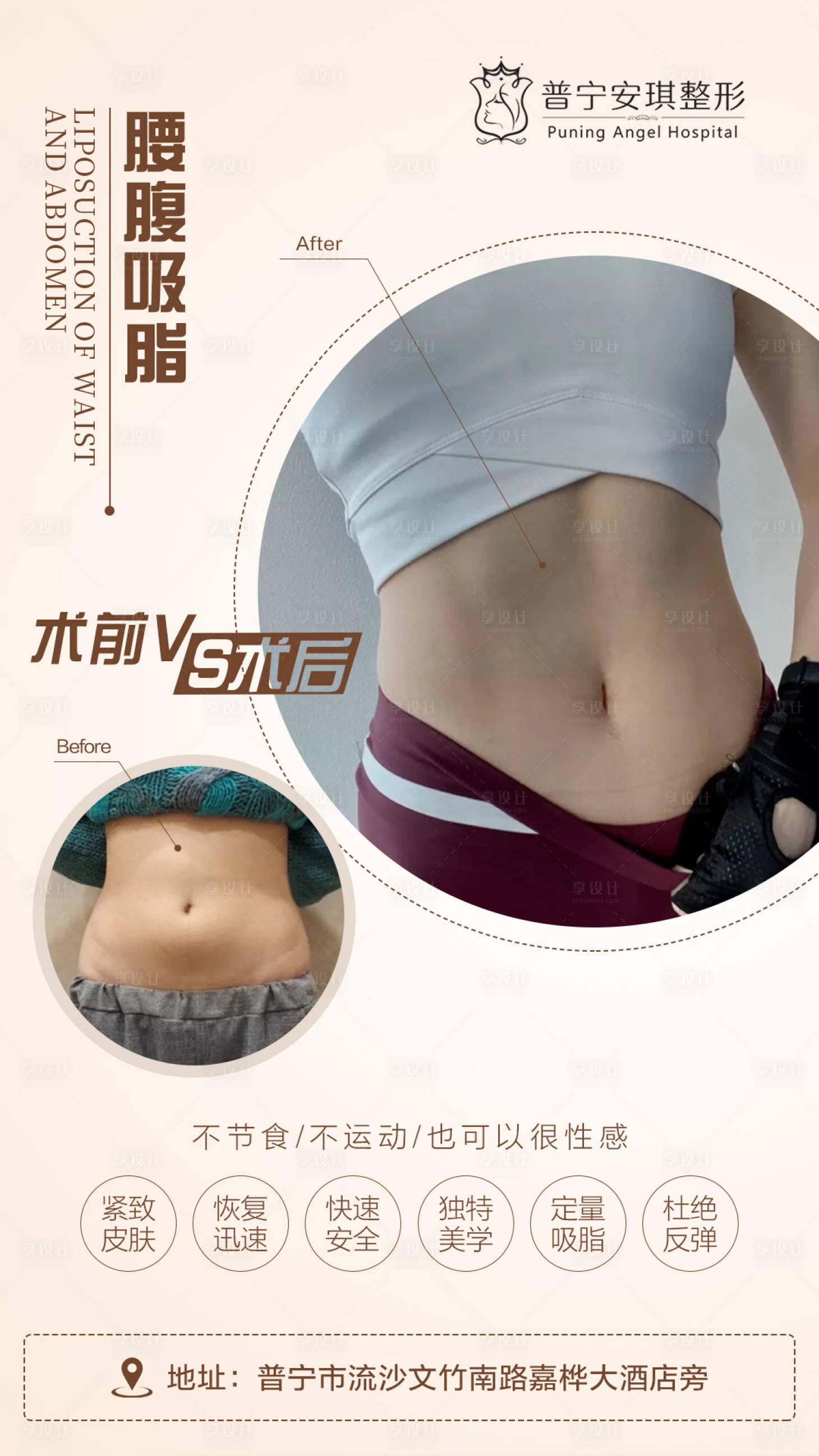 源文件下载【吸脂塑形】编号：62970003087178546