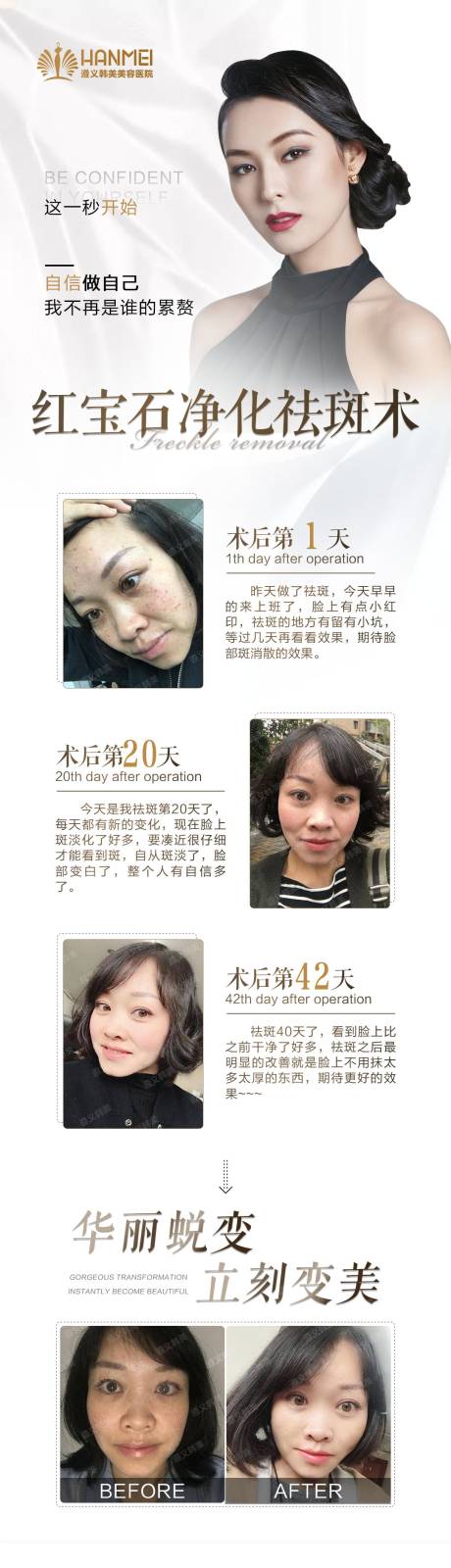 源文件下载【医美整形案例祛斑长图】编号：39830003278037888