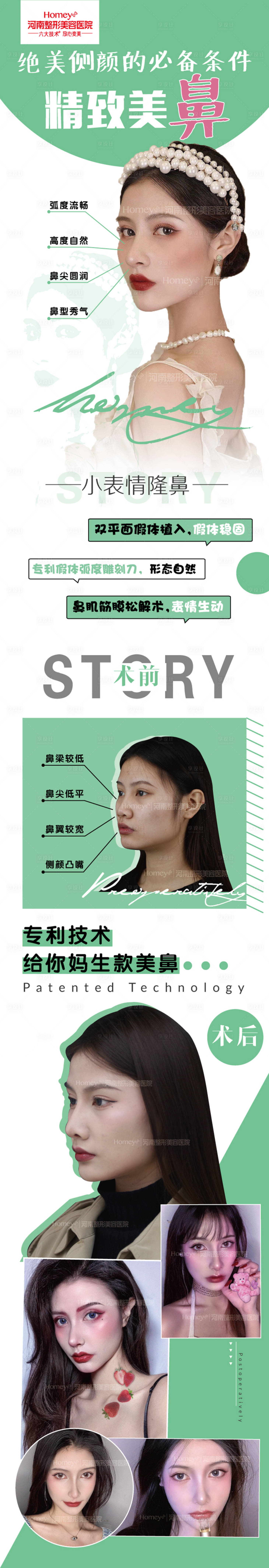 源文件下载【享设计】搜索编号：27950003415807925【医美案例】