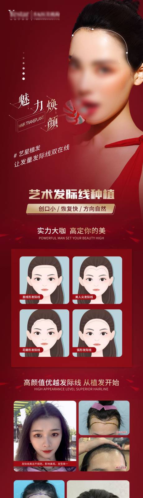 源文件下载【医美植发宣传长图】编号：85030003349167530