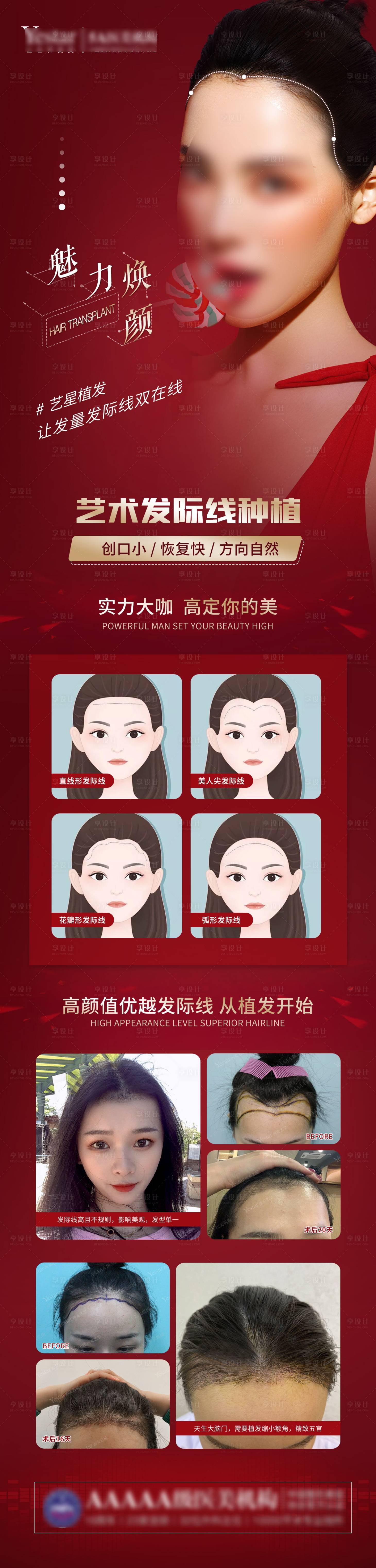 源文件下载【医美植发宣传长图】编号：85030003349167530