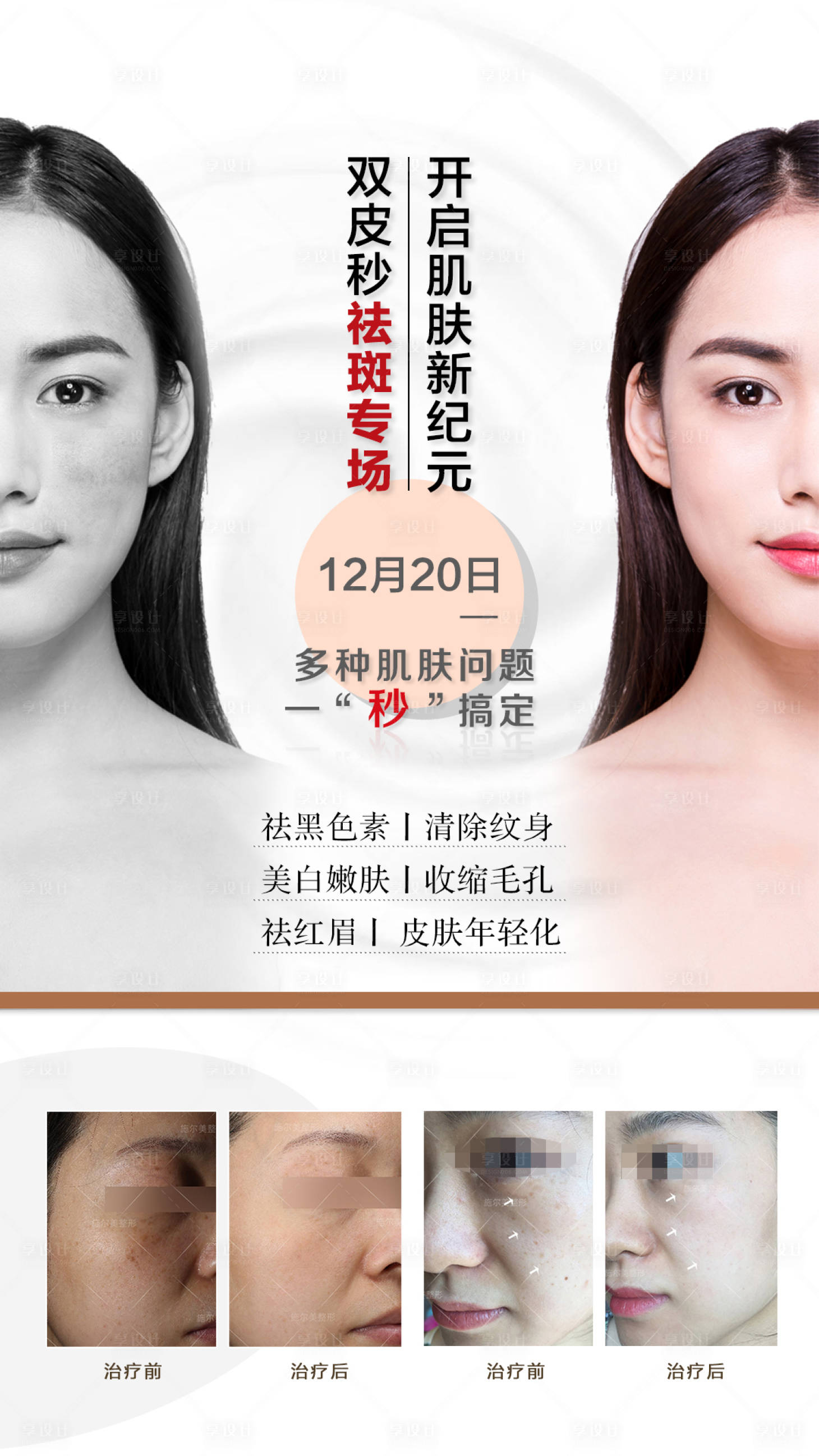 源文件下载【皮秒朋友圈海报】编号：61230003126434006