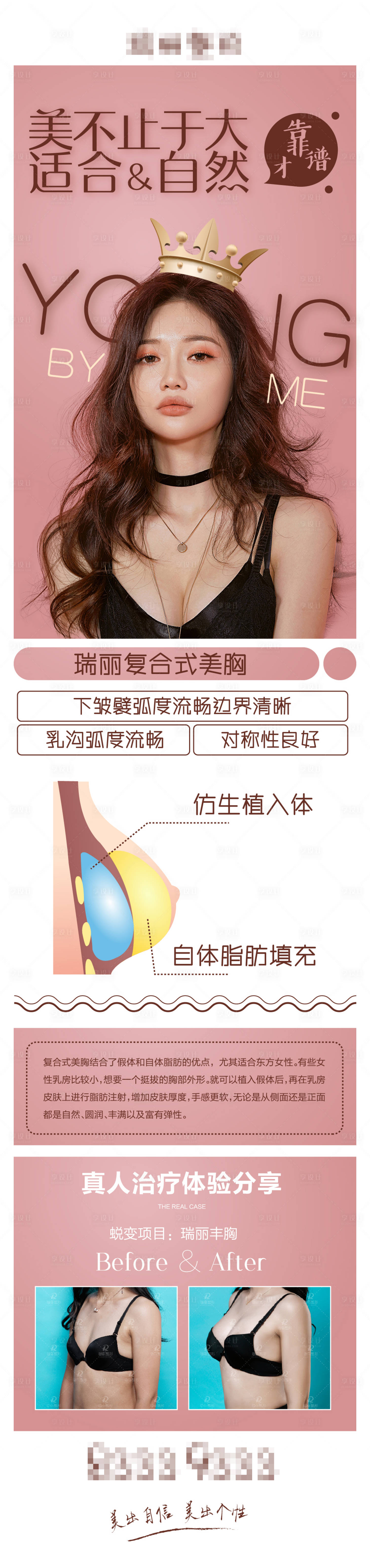 源文件下载【医疗美容丰胸详情页】编号：68660003131619703
