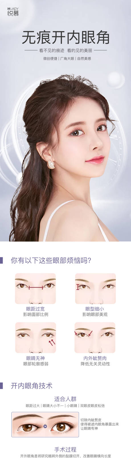 源文件下载【医美开内眼角科普详情】编号：28040003445574773