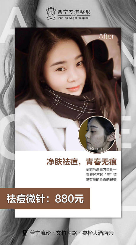 源文件下载【享设计】搜索编号：24770003494763888【祛痘微针整形海报】