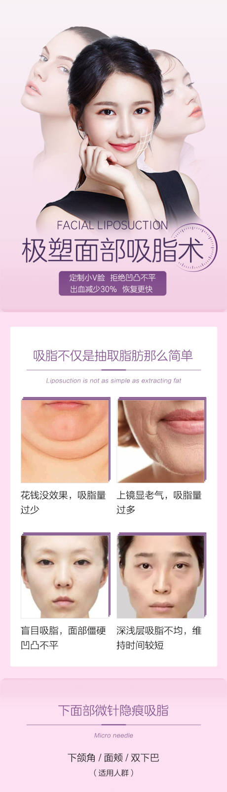 源文件下载【医美面部吸脂详情页】编号：36940003598474021