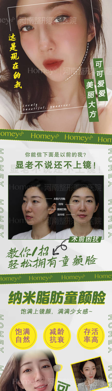 源文件下載【醫美案例長圖海報】編號：61380003560402475