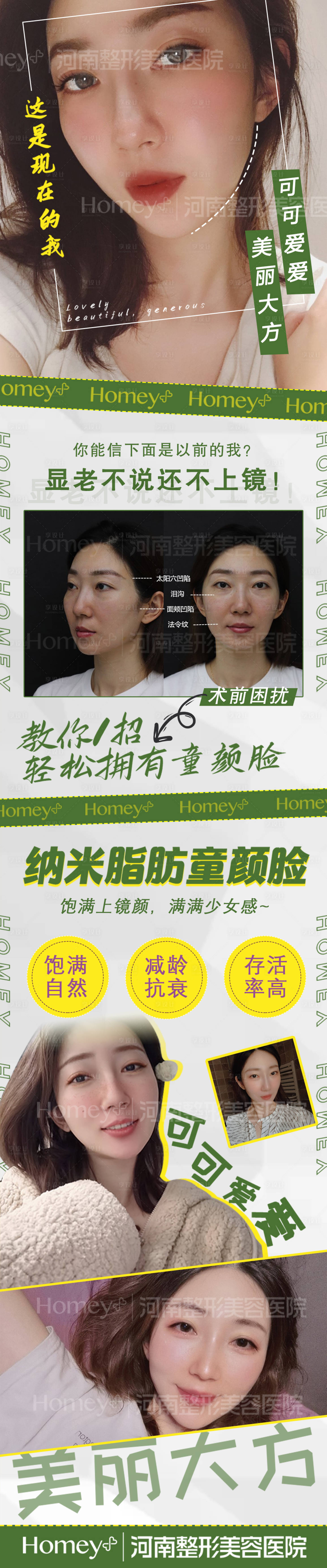 源文件下載【醫(yī)美案例長(zhǎng)圖海報(bào)】編號(hào)：61380003560402475