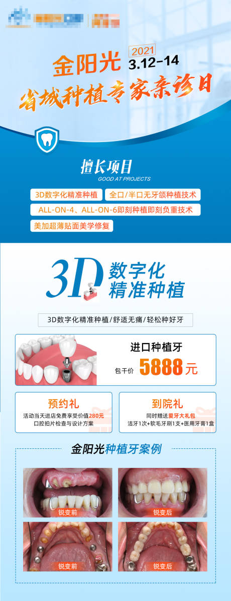 源文件下载【享设计】搜索编号：90650003734665635【种植牙海报】