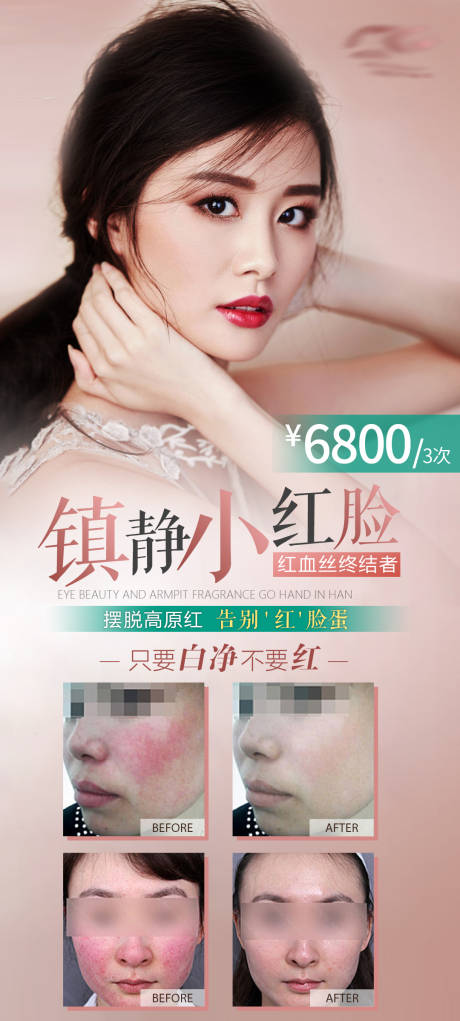 源文件下载【红血丝案例海报】编号：85260003956366193
