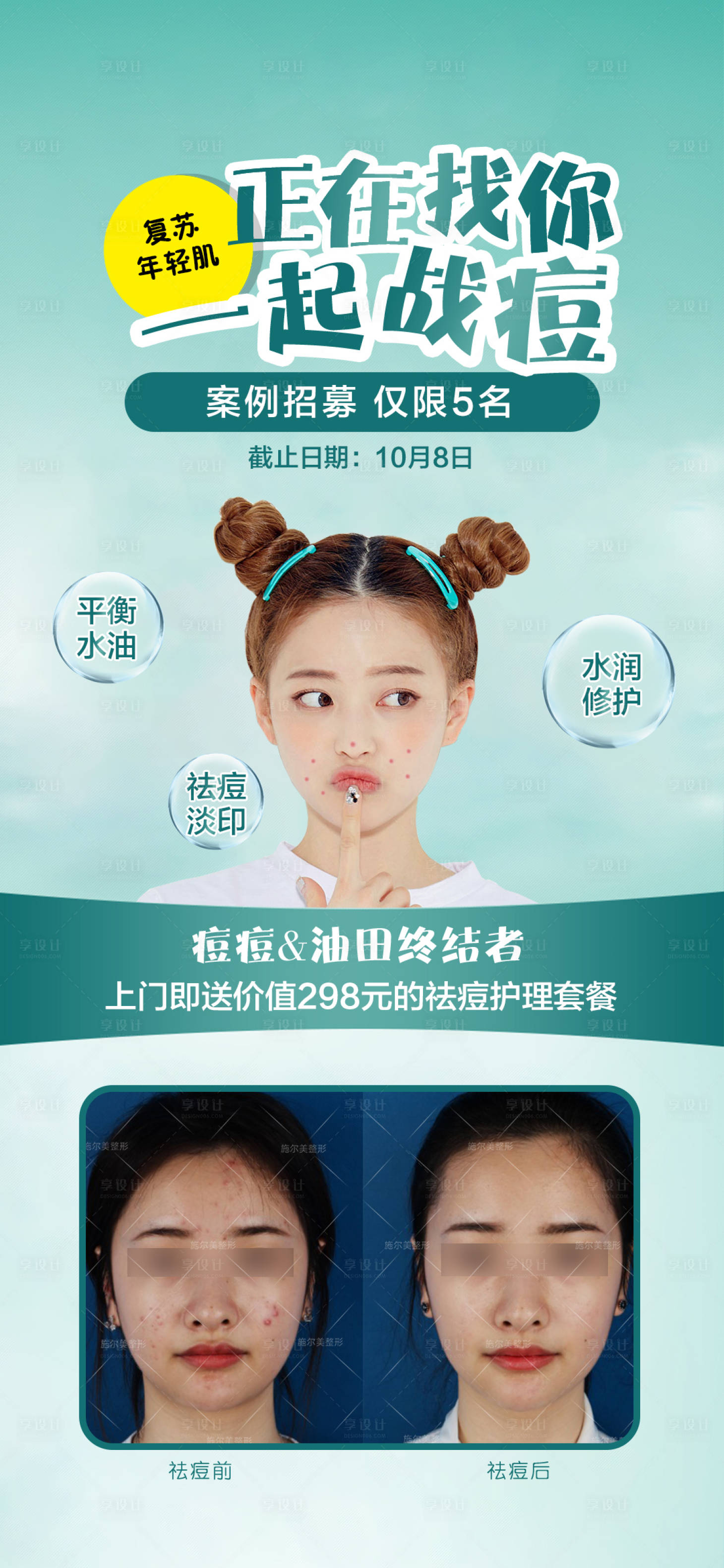 源文件下載【享設(shè)計】搜索編號：72940003928283139【祛痘招募朋友圈海報】