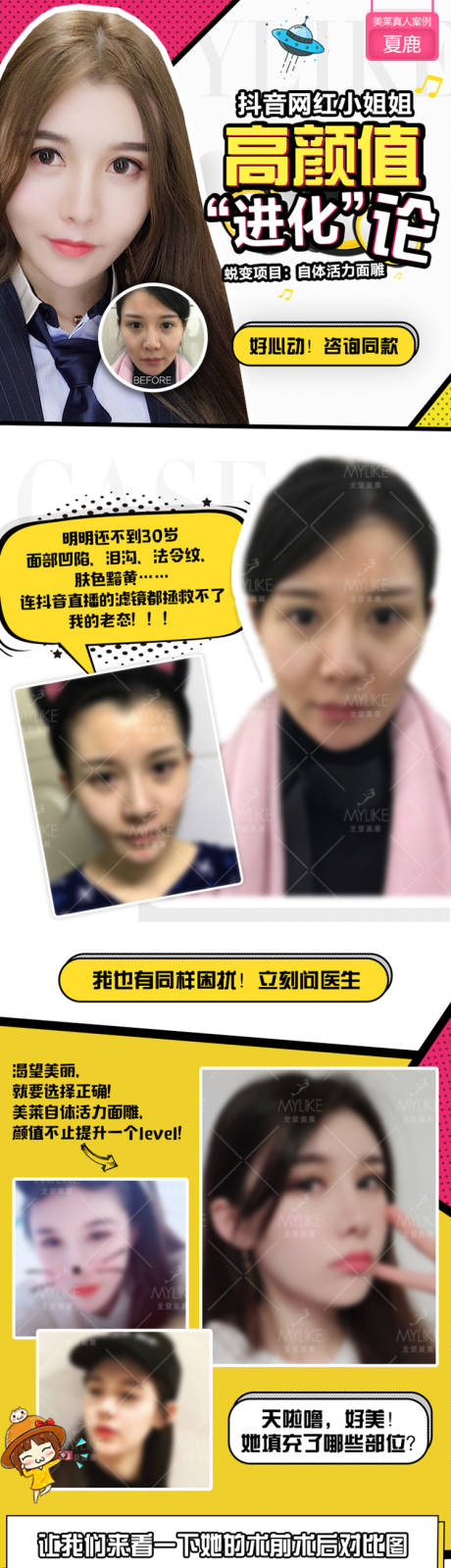 源文件下载【医美自体脂肪填充详情页】编号：87320003991904662