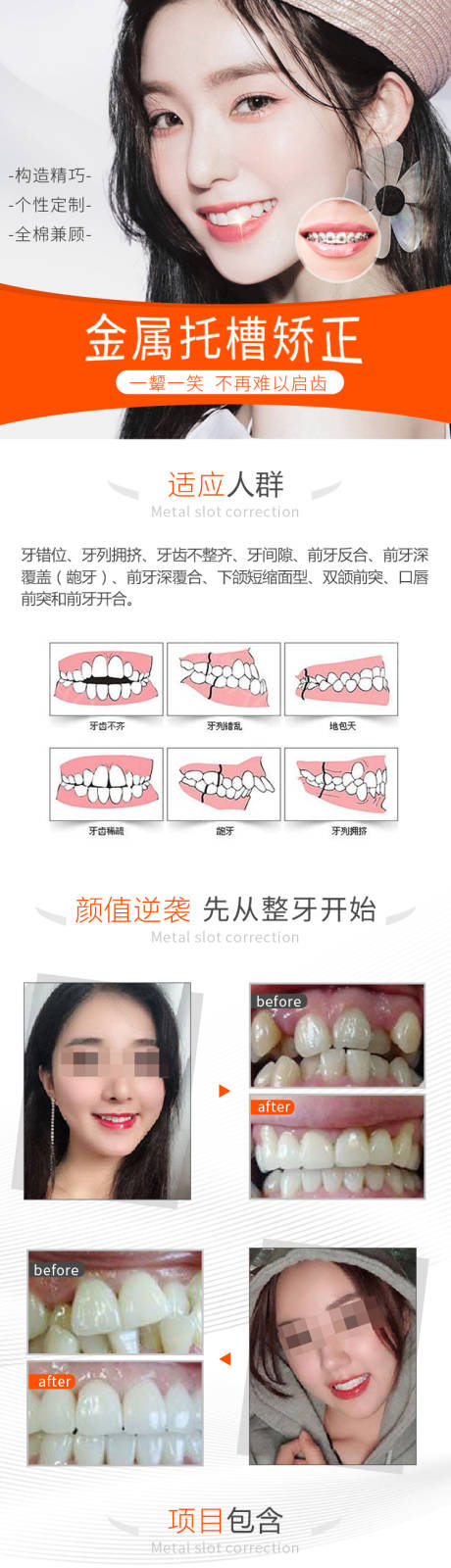 源文件下载【金属托槽矫正详情页】编号：20210304204818433