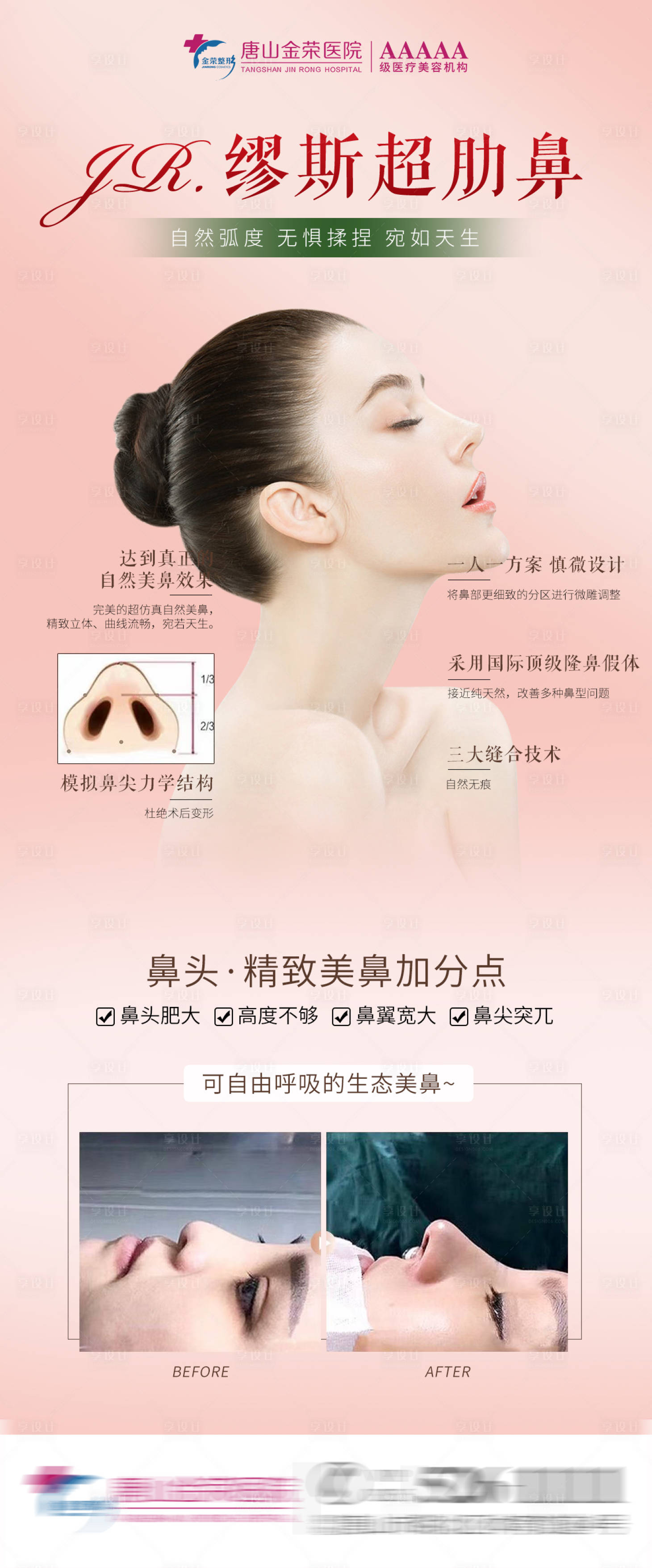 源文件下载【医美缪斯鼻假体海报】编号：69590003967874810