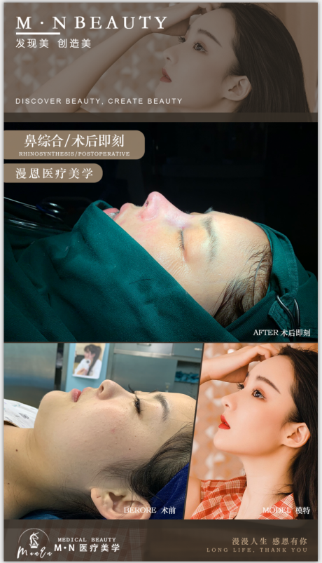 源文件下载【医美案例对比图】编号：75520004004974234